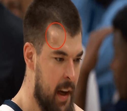 维多利亚巅,峰对决瑞模,贝雷,爱游戏app,爱游戏官网,爱游戏体育官网,爱游戏体育app