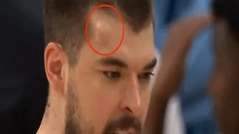 “维多利亚巅峰对决瑞模贝雷：实力对决，维多利亚能否稳占上风？”